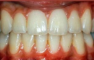 Clínica Dental Rodolfo Pita dientes saludables2